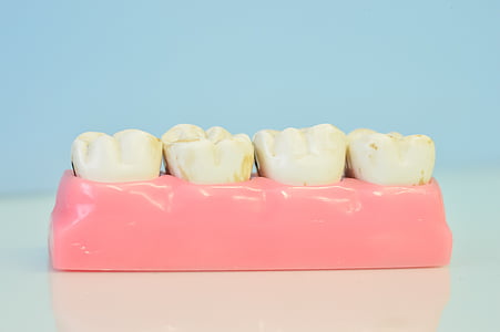 Macromodelo der Zähne, Zahnarztpraxis, Zähne