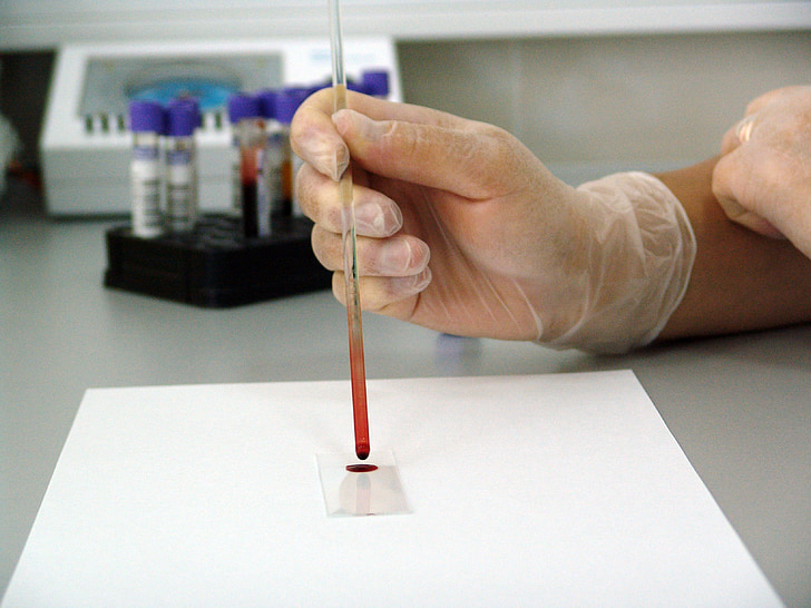 sangue, amostra, laboratório, laboratório, médica, gota, vidro