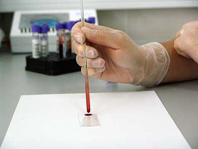 blood, sample, lab, laboratory, medical, drop, glass